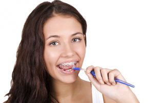 5 tips for cleaning orthodontic braces Miami FL
